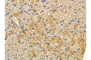 ABIN7094076 and ABIN7098120 at 1/100 staining mouse liver tissue by IHC-P. (ARMC10 antibody  (Internal Region))