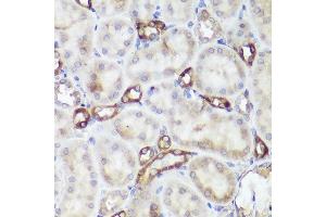 Immunohistochemistry of paraffin-embedded rat kidney using CASR antibody (ABIN1678994, ABIN5663902, ABIN5663904 and ABIN6218520) at dilution of 1:50 (40x lens). (CASR antibody  (AA 874-1088))