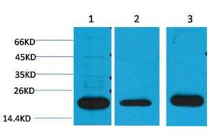 Western Blotting (WB) image for anti-Periaxin (PRX) antibody (ABIN3181501)