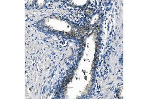IHC analysis of ASS1 using anti-ASS1 antibody (ABIN7601191). (ASS1 antibody  (AA 3-365))