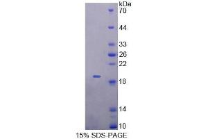 SDS-PAGE analysis of Mouse MTX1 Protein.