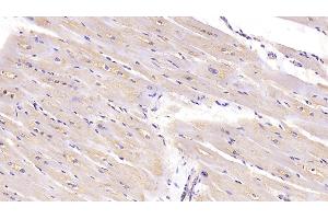 Detection of CTGF in Human Cardiac Muscle Tissue using Monoclonal Antibody to Connective Tissue Growth Factor (CTGF) (CTGF antibody  (AA 80-200))