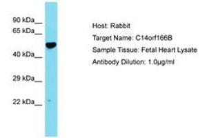 Image no. 1 for anti-Chromosome 14 Open Reading Frame 166B (C14ORF166B) (AA 26-75) antibody (ABIN6750760) (C14orf166B antibody  (AA 26-75))