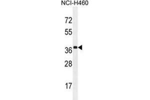 ZC3H15 Antibody (C-term) western blot analysis in NCI-H460 cell line lysates (35 µg/lane). (ZC3H15 antibody  (C-Term))