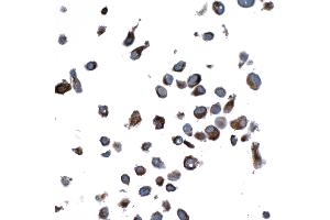 Immunocytochemistry (ICC) image for anti-Vimentin (VIM) (AA 325-375) antibody (ABIN7449539)
