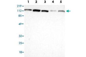 Western Blot (Cell lysate) analysis with VCL polyclonal antibody  at 1:100 - 1:250 dilution Lane 1: Human cell line RT-4 Lane 2: Human cell line U-251MG sp Lane 3: Human cell line A-431 Lane 4: Human liver tissue Lane 5: Human tonsil tissue (Vinculin antibody)