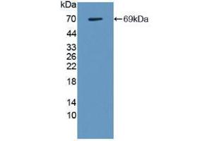 Image no. 3 for Lectin, Galactoside-Binding, Soluble, 9 (LGALS9) (AA 1-355) (Active) protein (His tag,GST tag) (ABIN5665803) (Galectin 9 Protein (AA 1-355) (His tag,GST tag))