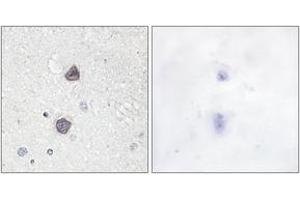 Immunohistochemistry analysis of paraffin-embedded human brain, using Aquaporin 2 (Phospho-Ser256) Antibody. (AQP2 antibody  (pSer256))