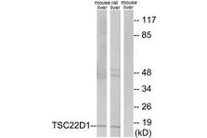 Western blot analysis of extracts from mouse liver/rat liver cells, using TSC22D1 Antibody. (TSC22D1 antibody  (AA 71-120))