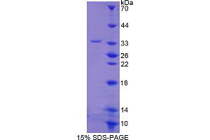 Image no. 1 for Protein tyrosine Phosphatase, Receptor Type, O (PTPRO) (AA 948-1205) protein (His tag) (ABIN4988669)