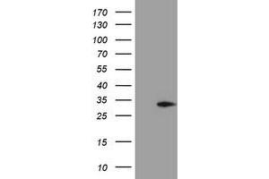 HEK293T cells were transfected with the pCMV6-ENTRY control (Left lane) or pCMV6-ENTRY MMACHC (Right lane) cDNA for 48 hrs and lysed. (MMACHC antibody)
