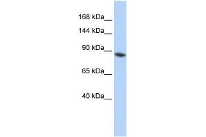 WB Suggested Anti-JMJD2B Antibody Titration: 0. (KDM4B antibody  (Middle Region))