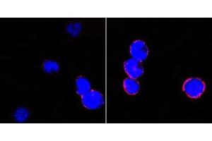 Confocal immunofluorescence analysis of BCBL-1 cells (left) and L1210 cells (right) using CD18 mouse mAb (red). (Integrin beta 2 antibody)