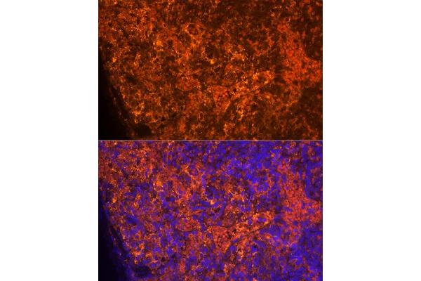 CCL5 antibody  (AA 24-91)