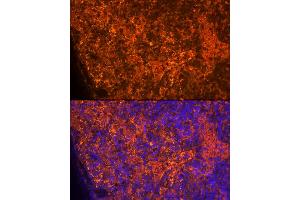Immunofluorescence analysis of Rat spleen using CCL5/RANTES antibody (ABIN6129369, ABIN6138063, ABIN6138065 and ABIN6218473) at dilution of 1:100. (CCL5 antibody  (AA 24-91))