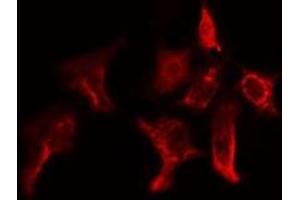 ABIN6275155 staining Hela cells by IF/ICC. (GSTT1 antibody  (N-Term))