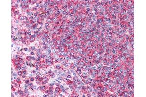 HSPA8 antibody was used for immunohistochemistry at a concentration of 4-8 ug/ml. (Hsc70 antibody  (N-Term))