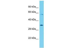 Host: Rabbit Target Name: Ythdf1 Sample Type: Rat Thymus lysates Antibody Dilution: 1. (YTHDF1 antibody  (N-Term))