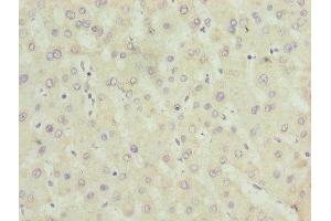 Immunohistochemistry of paraffin-embedded human liver tissue using ABIN7142596 at dilution of 1:100