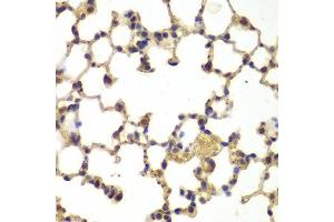 Immunohistochemistry of paraffin-embedded mouse lung using NFKB1 antibody at dilution of 1:200 (400x lens). (NFKB1 antibody)
