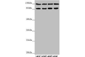 Western blot All lanes: SCYL1 antibody at 3. (SCYL1 antibody  (AA 460-740))