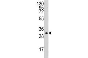 Western blot analysis of Cyclin C antibody and HL-60 lysate. (Cyclin C antibody  (AA 221-249))