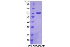 Image no. 1 for Platelet Derived Growth Factor D (PDGFD) (AA 53-315) protein (His tag) (ABIN6237392) (PDGFD Protein (AA 53-315) (His tag))
