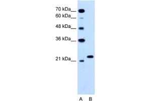 Western Blotting (WB) image for anti-RAB14, Member RAS Oncogene Family (RAB14) antibody (ABIN2463772) (RAB14 antibody)