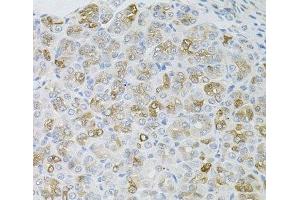 Immunohistochemistry of paraffin-embedded Mouse stomach using HPS1 Polyclonal Antibody at dilution of 1:100 (40x lens). (HPS1 antibody)