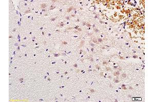 Formalin-fixed and paraffin embedded rat brain labeled with Anti-MSH gamma Polyclonal Antibody, Unconjugated (ABIN751123) at 1:200 followed by conjugation to the secondary antibody and DAB staining (gamma MSH (AA 51-150) antibody)