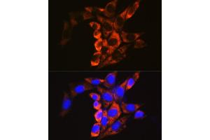 Immunofluorescence analysis of NIH/3T3 cells using Calpain 1 antibody (ABIN3021622, ABIN3021623, ABIN3021624, ABIN1512666 and ABIN6215416) at dilution of 1:100.