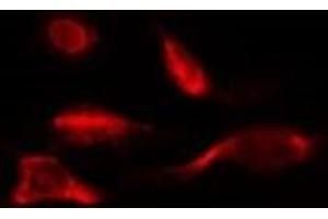 ABIN6278062 staining HepG2 by IF/ICC. (Ferredoxin1 (FDX1) (Internal Region) antibody)