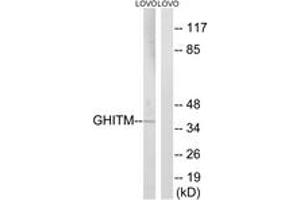 Western Blotting (WB) image for anti-Growth Hormone Inducible Transmembrane Protein (GHITM) (AA 31-80) antibody (ABIN2890353) (GHITM antibody  (AA 31-80))