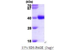 SDS-PAGE (SDS) image for UDP-Galactose-4-Epimerase (GALE) (AA 1-348) protein (His tag) (ABIN667033)