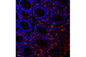 Immunofluorescence of paraffin embedded human colon using scr3 (ABIN7074886) at dilution of 1:2000 (400x lens) (NCOA3 antibody)