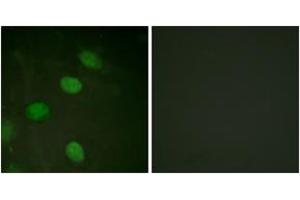 Immunofluorescence analysis of HeLa cells, using c-Jun (Phospho-Thr231) Antibody. (C-JUN antibody  (pThr231))
