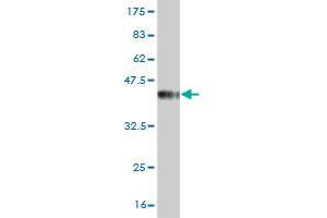 Western Blot detection against Immunogen (37. (PIK3C2B antibody  (AA 1-110))