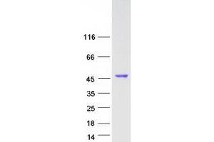 Western Blotting (WB) image for Glutamine Synthetase (GLN1) (Transcript Variant 2) protein (Myc-DYKDDDDK Tag) (ABIN2722012)