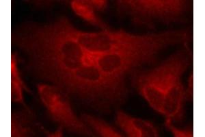 Immunofluorescence staining of methanol-fixed Hela cells using Bcr(Ab-177) Antibody. (BCR antibody)
