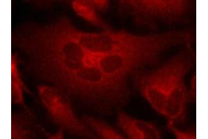 Immunofluorescence staining of methanol-fixed Hela cells using Bcr(Ab-177) Antibody. (BCR antibody)