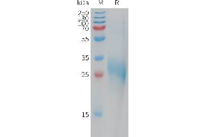 C-Type Lectin Domain Family 1, Member B (CLEC1B) (AA 55-229) protein (His tag)