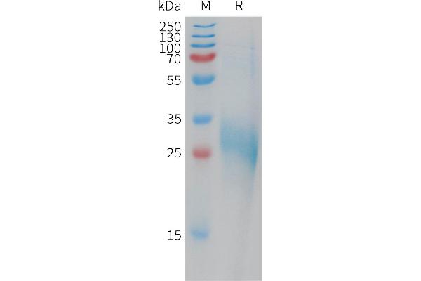 C-Type Lectin Domain Family 1, Member B (CLEC1B) (AA 55-229) protein (His tag)