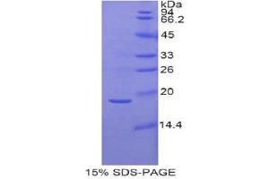SDS-PAGE (SDS) image for Gastrokine 3 (GKN3) (AA 13-166) protein (His tag) (ABIN1878130) (Gastrokine 3 Protein (GKN3) (AA 13-166) (His tag))