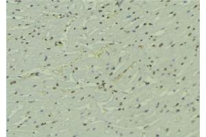 ABIN6274041 at 1/100 staining Mouse muscle tissue by IHC-P.