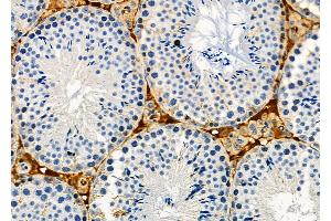 ABIN6262587 and ABIN6273127 at 1/100 staining Mouse testis tissue by IHC-P.