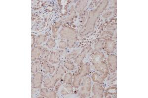 Immunohistochemistry (Paraffin-embedded Sections) (IHC (p)) image for anti-Discoidin Domain Receptor tyrosine Kinase 1 (DDR1) (AA 299-330) antibody (ABIN391458)