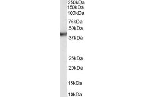 Image no. 1 for anti-Vacuolar Protein Sorting 37C (VPS37C) (Internal Region) antibody (ABIN374584) (VPS37C antibody  (Internal Region))