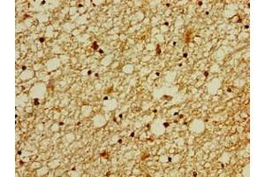 Immunohistochemistry of paraffin-embedded human brain tissue using ABIN7176339 at dilution of 1:100 (ZNF488 antibody  (AA 1-200))