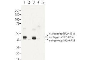 Image no. 1 for anti-Ribonucleotide Reductase M2 B (TP53 Inducible) (RRM2B) (N-Term) antibody (ABIN1104077) (RRM2B antibody  (N-Term))