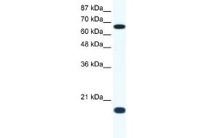 Western Blot showing CUL1 antibody used at a concentration of 1-2 ug/ml to detect its target protein. (Cullin 1 antibody  (C-Term))